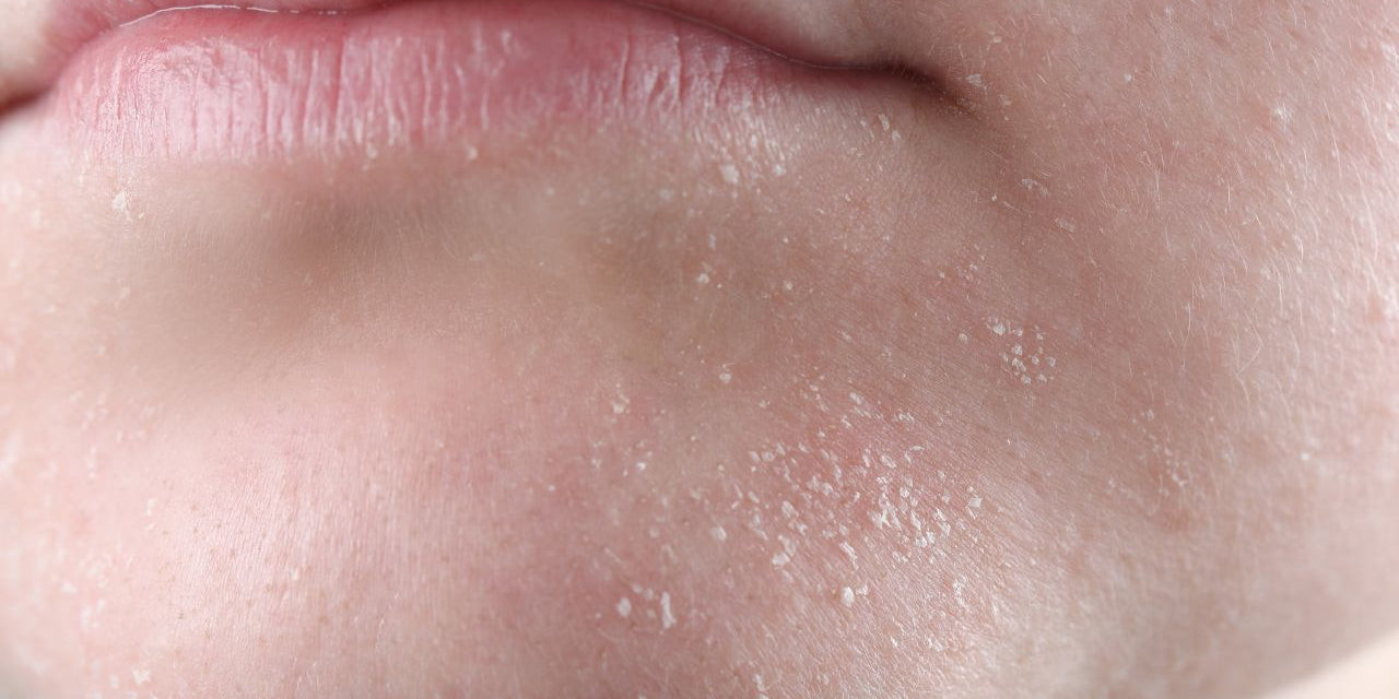 Hydratation et peaux sensibles Azul Cosmétique