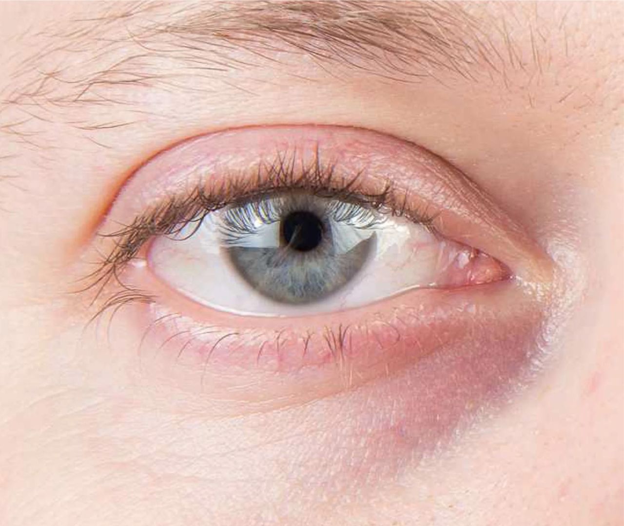 Cernes et poches Azul Cosmétique