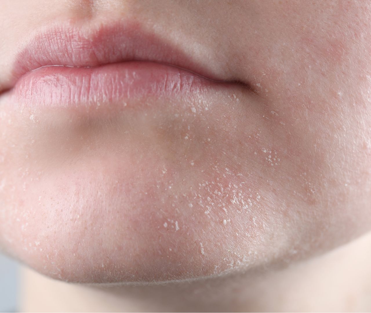 Hydratation et peaux sensibles Azul Cosmétique